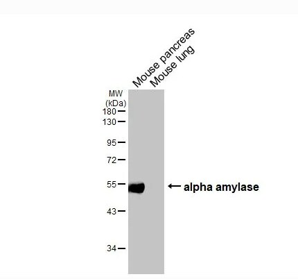 Alpha Amylase Antibody (HL1681)