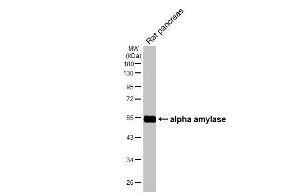 Alpha Amylase Antibody (HL1681)
