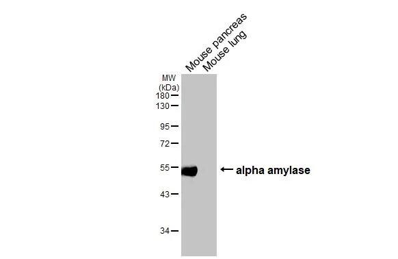 Alpha Amylase Antibody (HL1681)