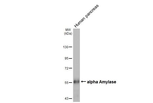 Alpha Amylase Antibody (HL1681)