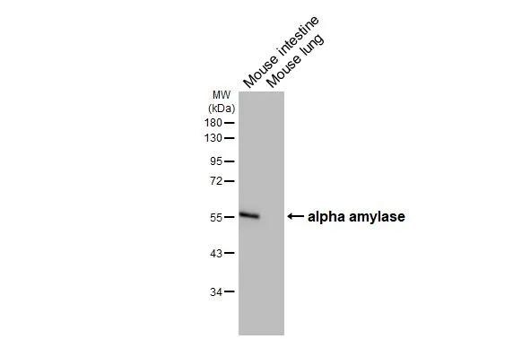 Alpha Amylase Antibody (HL1681)