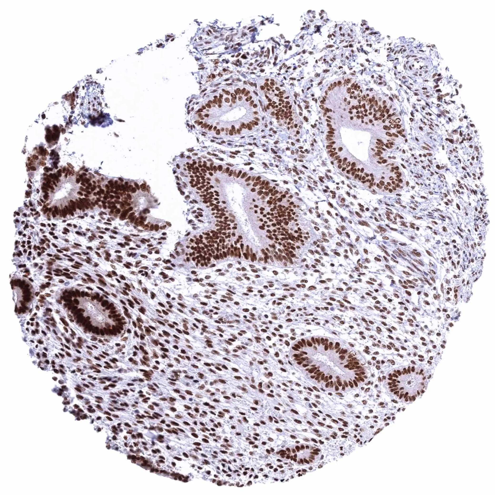 KDM6A Antibody (HMV311)