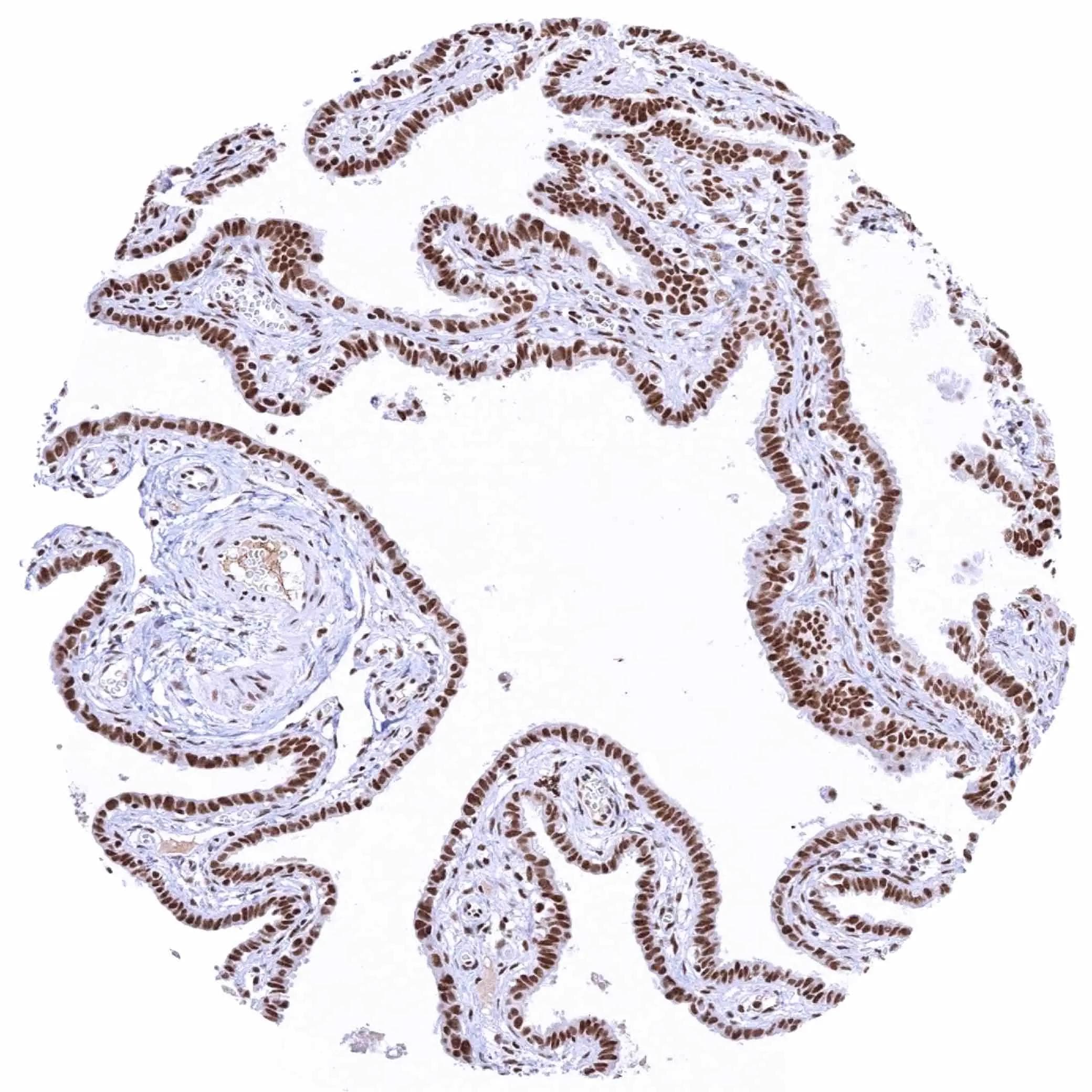 KDM6A Antibody (HMV311)