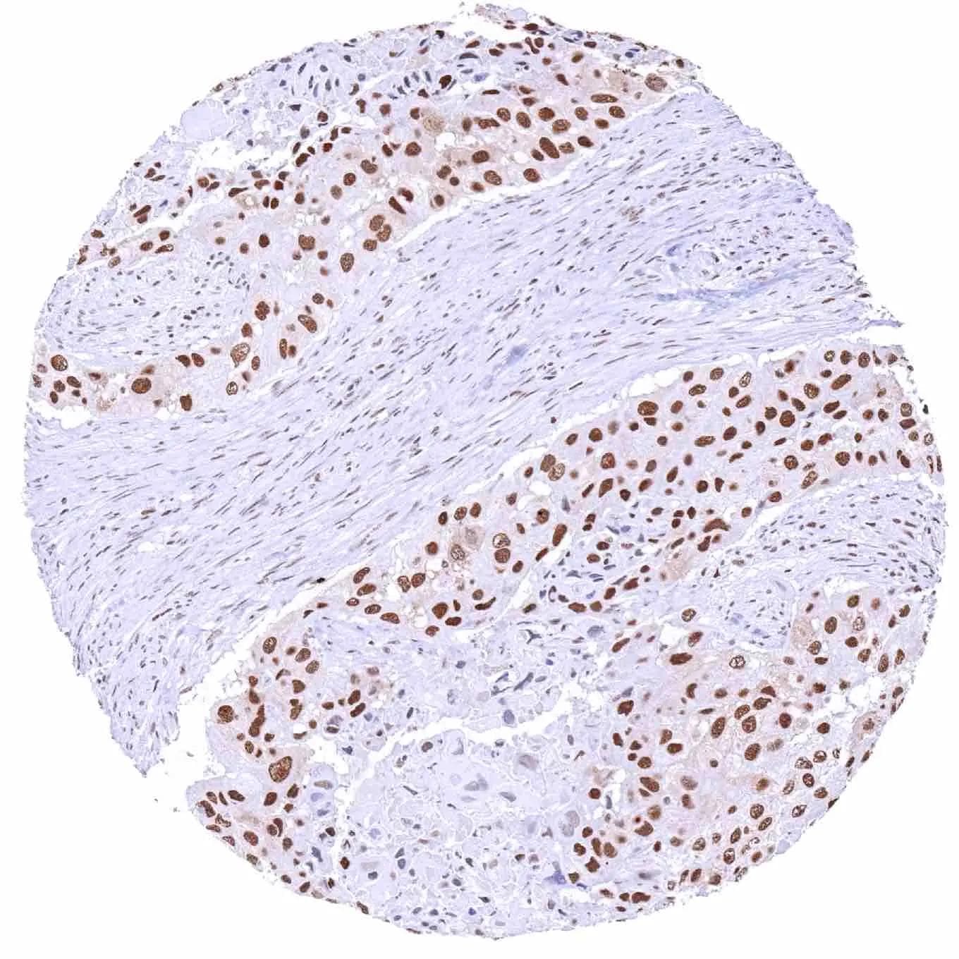 KDM6A Antibody (HMV311)
