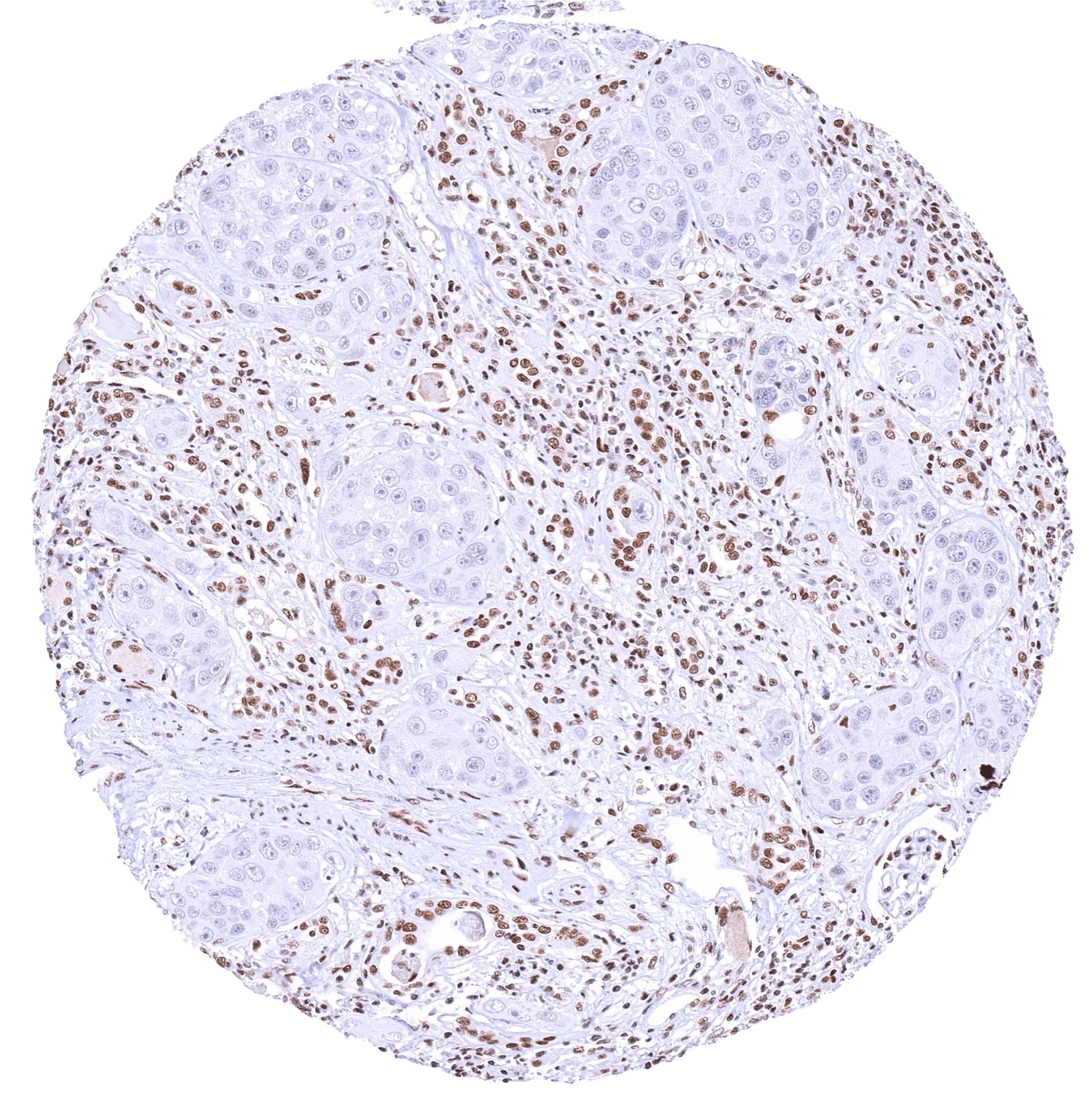 KDM6A Antibody (HMV311)