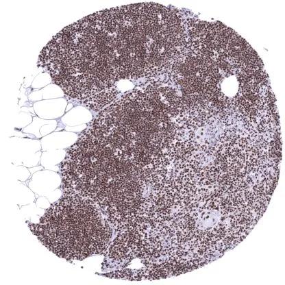 KDM6A Antibody (HMV311)