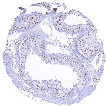 KDM6A Antibody (HMV311)