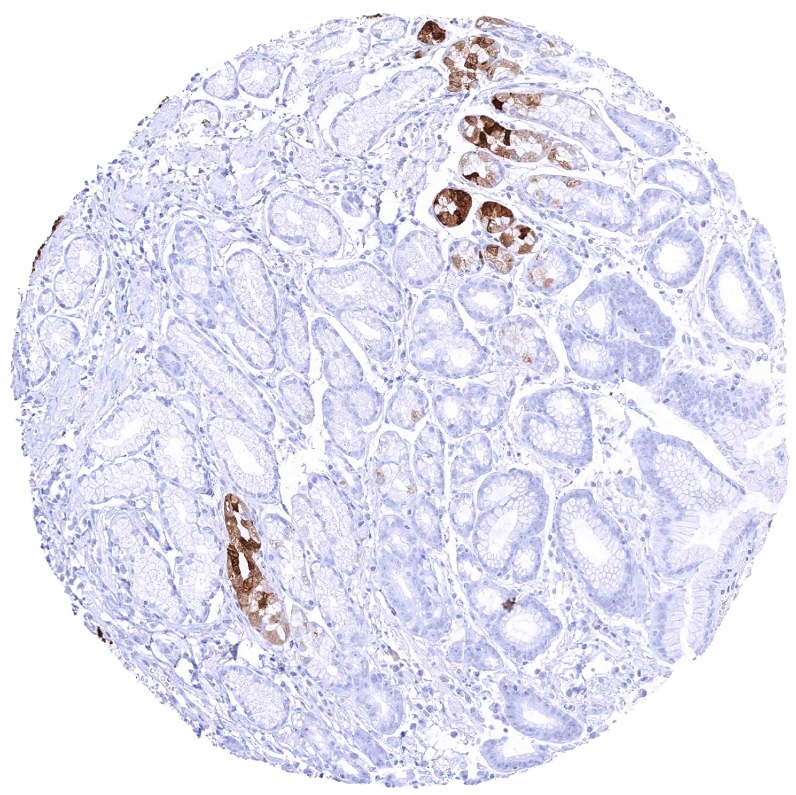 Pepsinogen I Antibody (HMV318)