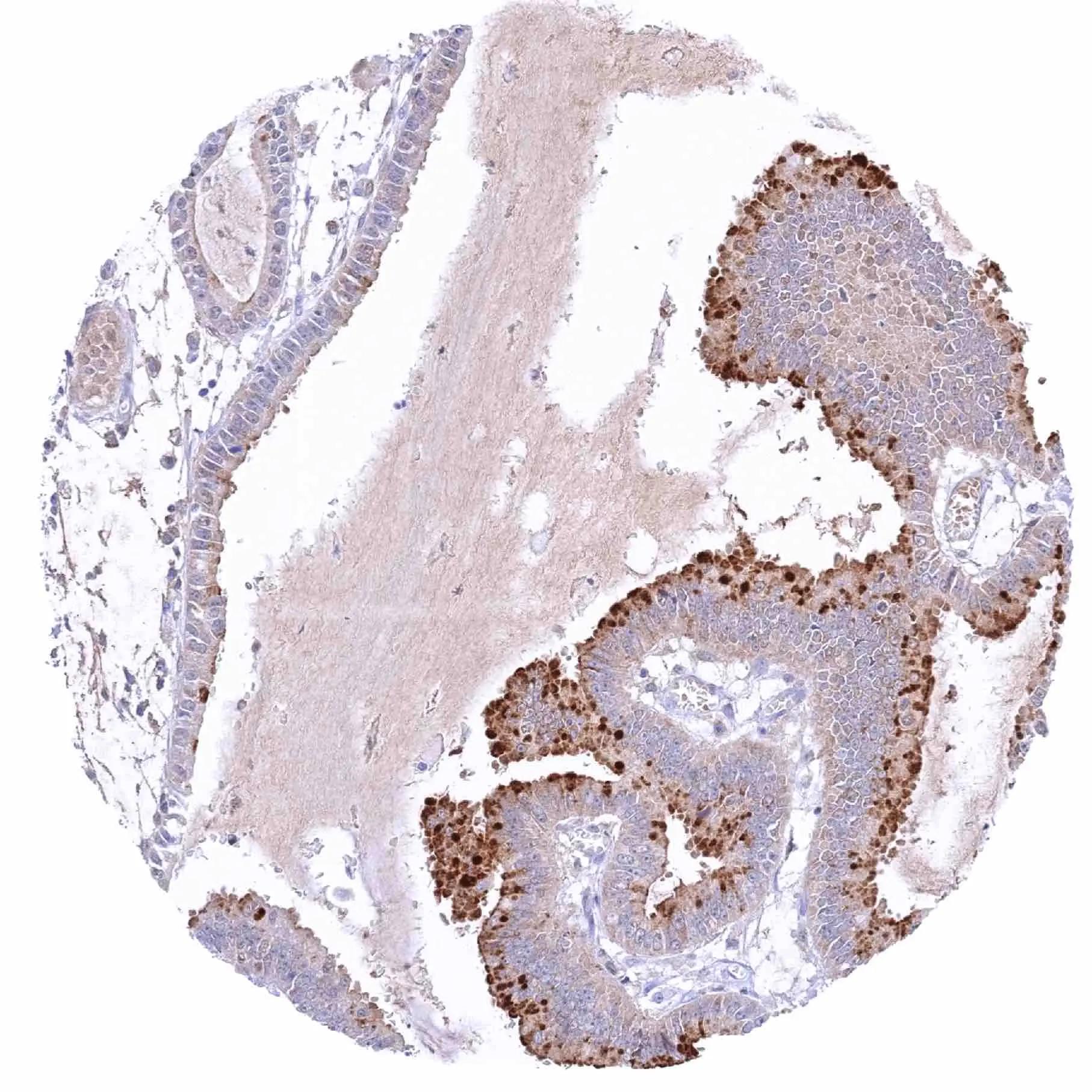 Pepsinogen I Antibody (HMV318)