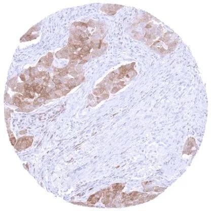 PSAT1 Antibody (HMV331)