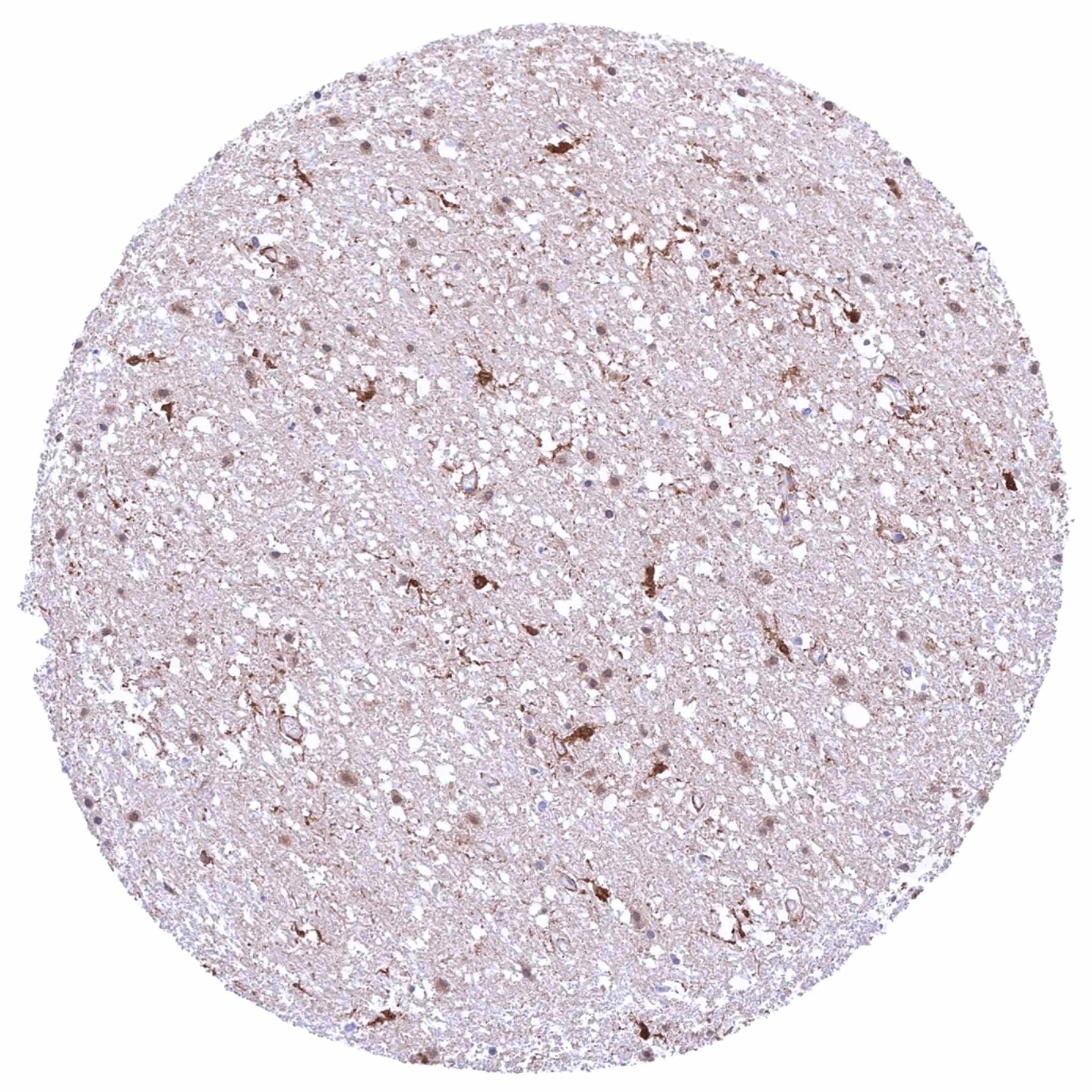 PSAT1 Antibody (HMV331)
