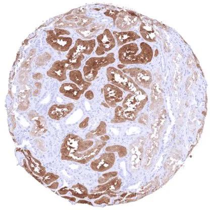 PSAT1 Antibody (HMV331)
