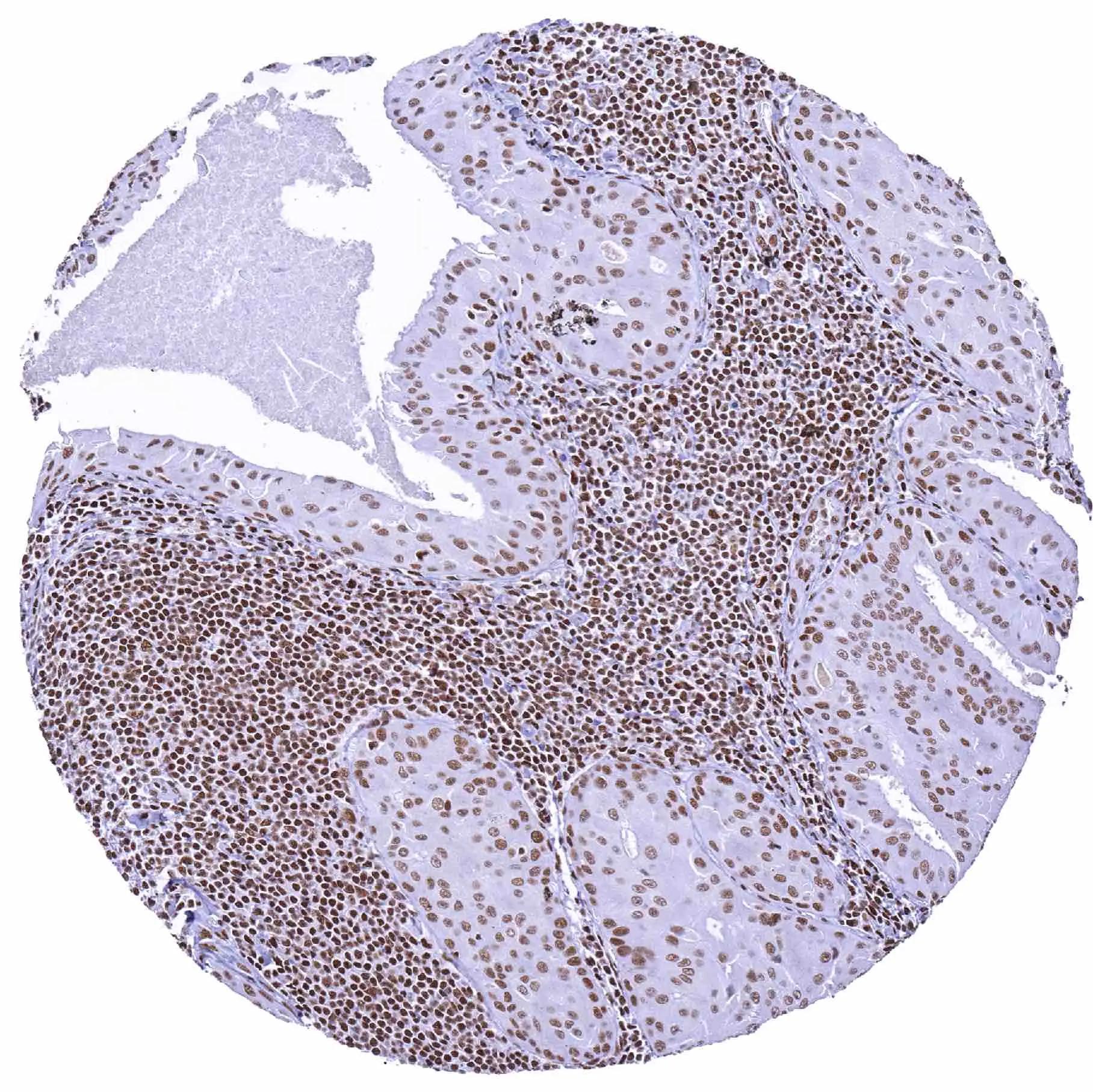BRM Antibody (HMV337)