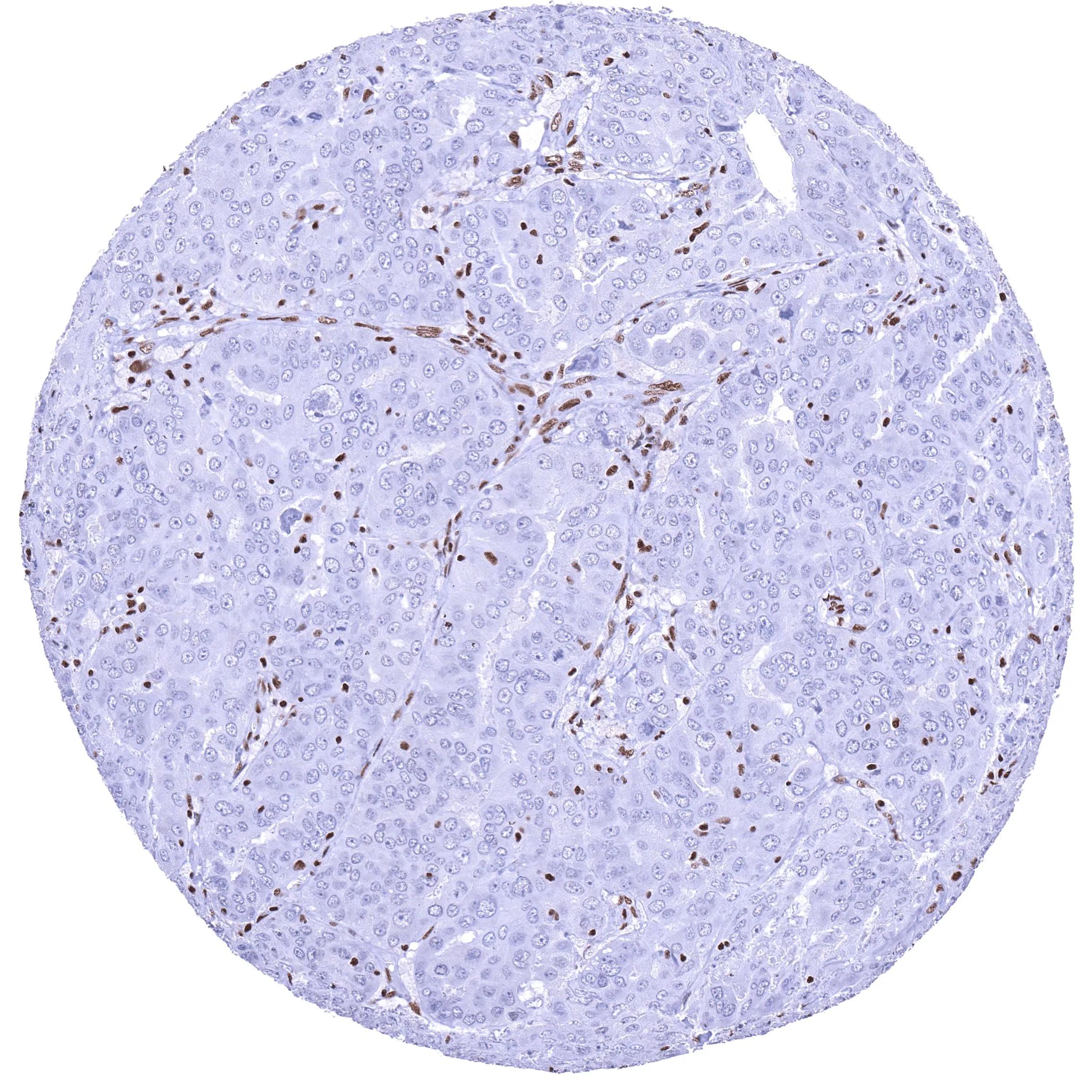 BRM Antibody (HMV337)