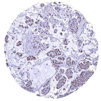 BRM Antibody (HMV337)