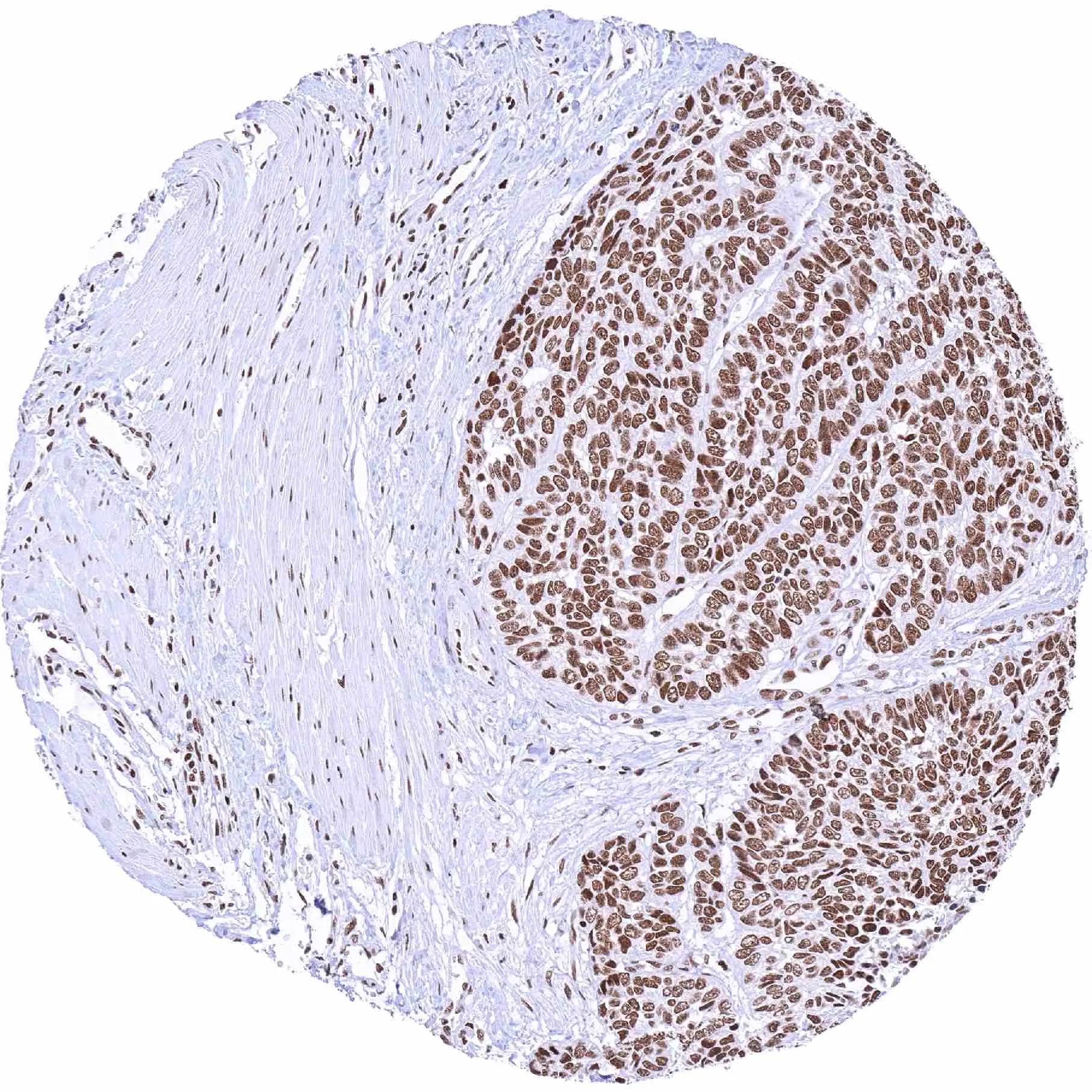 BRM Antibody (HMV337)