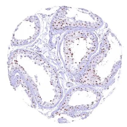 BRM Antibody (HMV337)