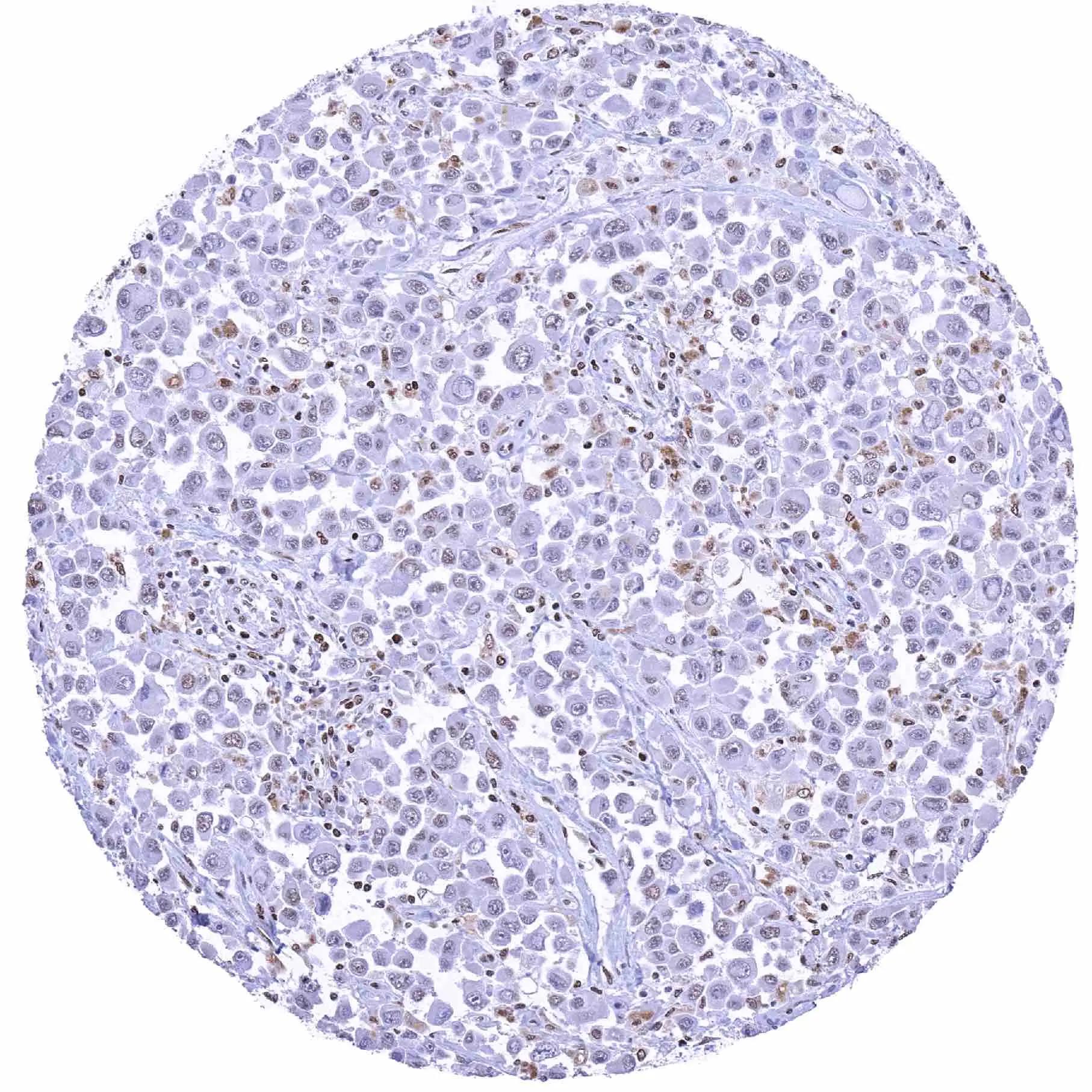 BRM Antibody (HMV337)