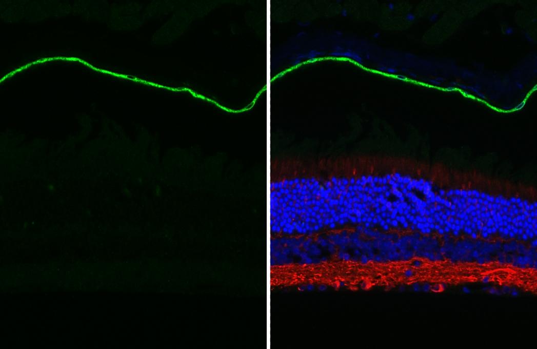 RGR Antibody (HL3056 + HL3058)