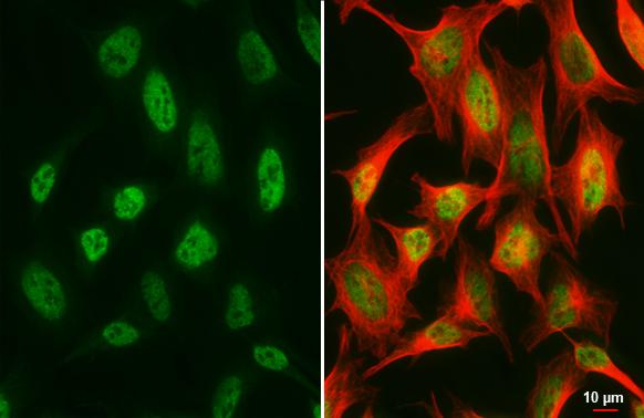 Suppressor of Fused Antibody (HL3375)