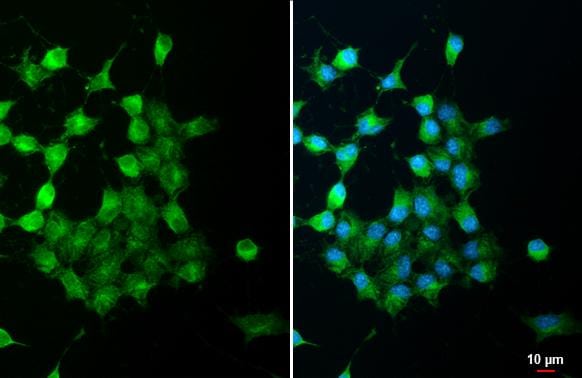 MAP3K12 Antibody (HL3423)