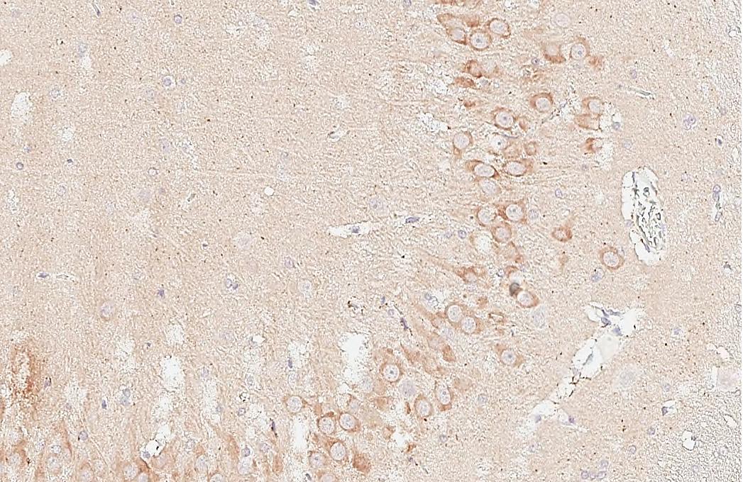 MAP3K12 Antibody (HL3423)