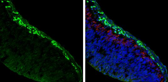 Acetylcholinesterase/ACHE Antibody - BSA Free