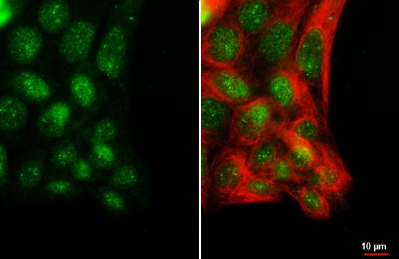 POLR3A Antibody (HL3437)