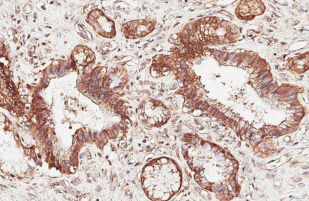 HEATR7B1 Antibody (HL3448)