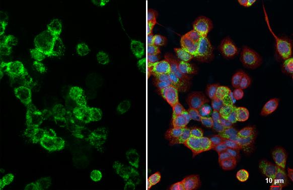 HKDC1 Antibody (HL3464)