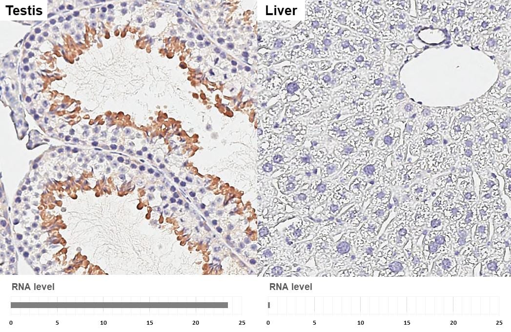 GEF-H1 Antibody (HL3470)
