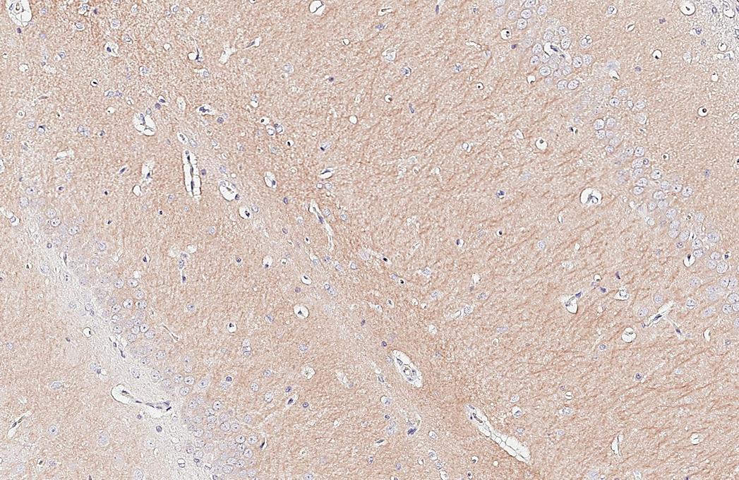 GEF-H1 Antibody (HL3470)