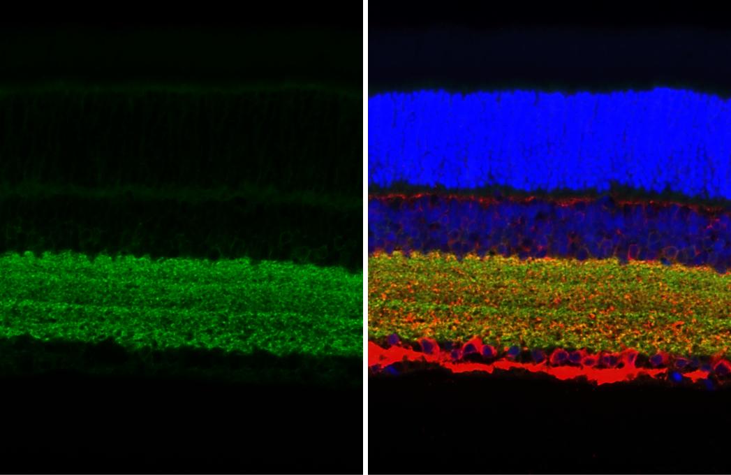 GAT-1/SLC6A1 Antibody (HL3475)