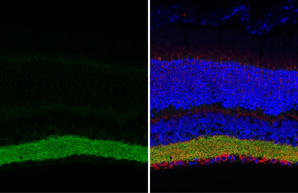 GAT-1/SLC6A1 Antibody (HL3475)