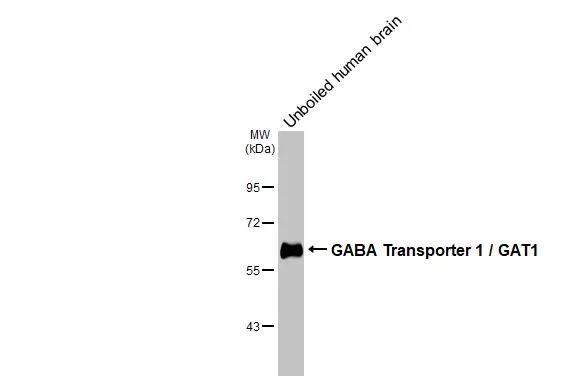 GAT-1/SLC6A1 Antibody (HL3475)