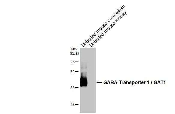 GAT-1/SLC6A1 Antibody (HL3475)