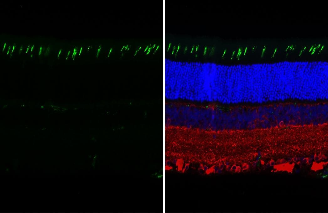 Opsin 1 (Medium Wave) Antibody (HL3484)