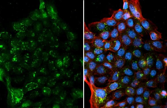 Neuromedin-U Antibody (HL3549)