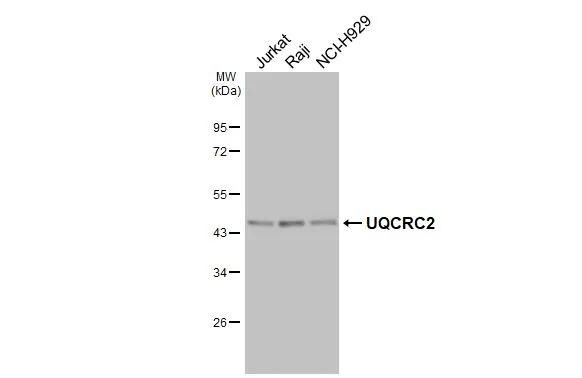 UQCRC2 Antibody (HL3638)