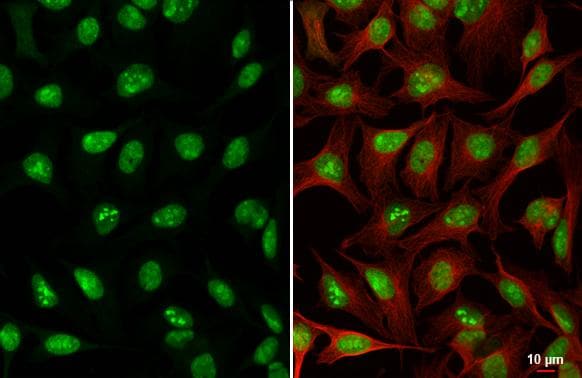 ADAR Antibody (HL3666)