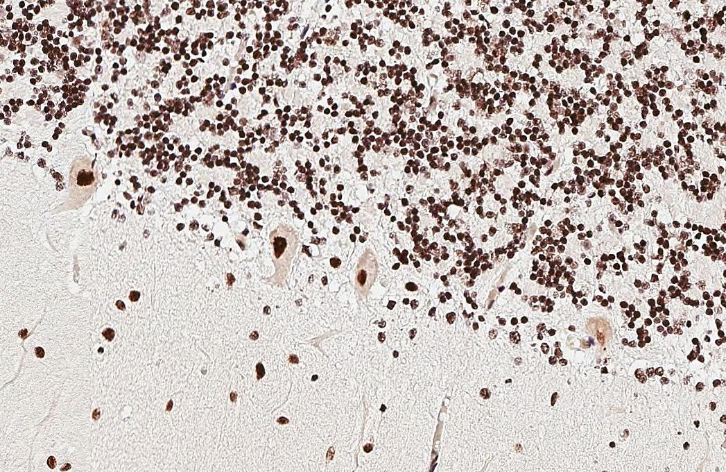 ADAR Antibody (HL3666)