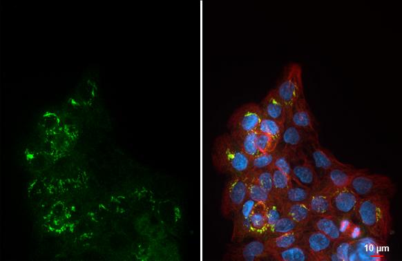 ORP8 Antibody (HL3673)