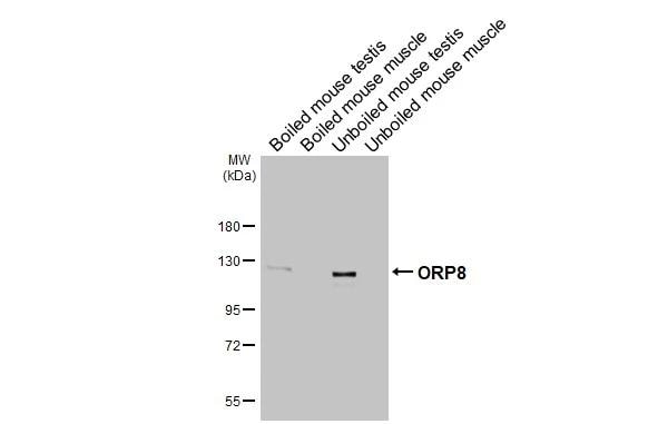 ORP8 Antibody (HL3673)
