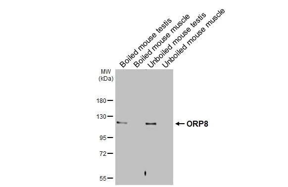 ORP8 Antibody (HL3674)