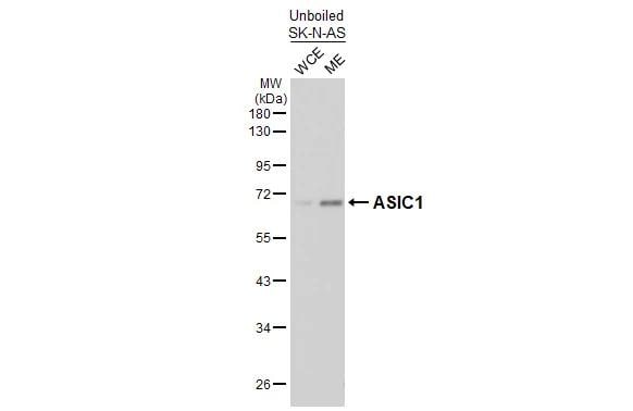 ACCN2 Antibody (GT73)