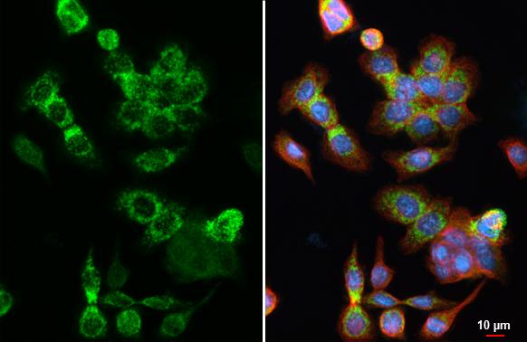 HKDC1 Antibody (HL3743)