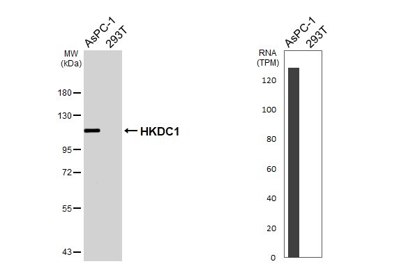 HKDC1 Antibody (HL3743)