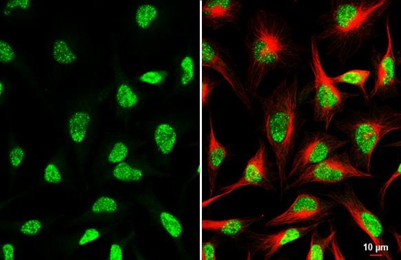 CDK12 Antibody (HL3757)