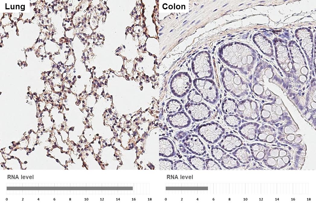 SH3PXD2A Antibody (GT88)