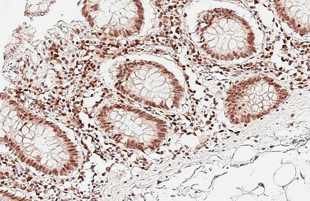 Aly Antibody (HL3813)